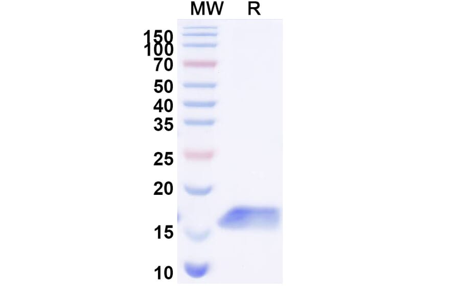 SDS-PAGE - Anti-Cadherin-17 Nanobody [SAA1325] (A337943) - Antibodies.com