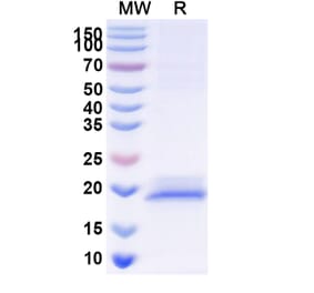 SDS-PAGE - Anti-KAP1 Nanobody [SAA1235] (A337944) - Antibodies.com