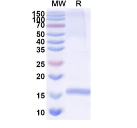 SDS-PAGE - Anti-SP140 Nanobody [SAA0901] (A337945) - Antibodies.com