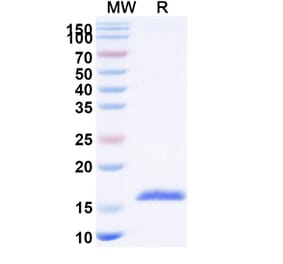 SDS-PAGE - Anti-ADAM9 Nanobody [SAA1216] (A337946) - Antibodies.com