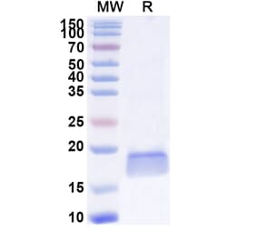 SDS-PAGE - Anti-PTCH1 Nanobody [SAA1343] (A337947) - Antibodies.com