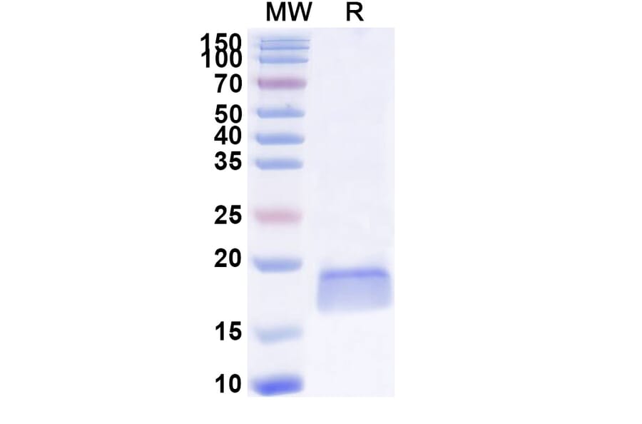 SDS-PAGE - Anti-PTCH1 Nanobody [SAA1343] (A337947) - Antibodies.com