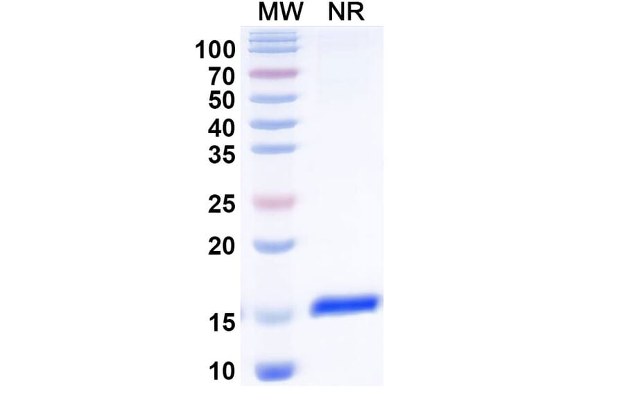 SDS-PAGE - Anti-PTCH1 Nanobody [SAA1006] (A337948) - Antibodies.com