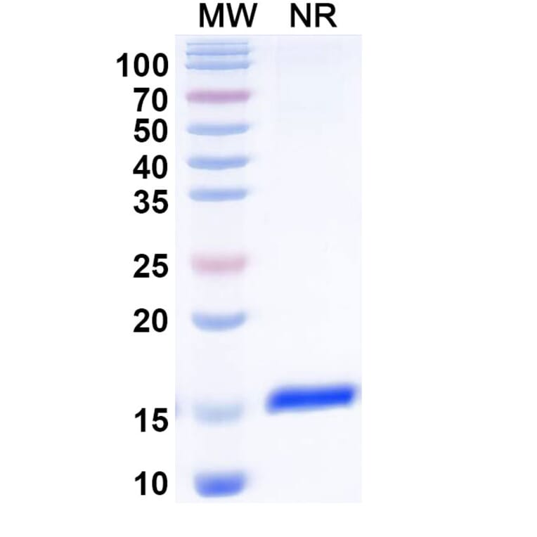 SDS-PAGE - Anti-PTCH1 Nanobody [SAA1006] (A337948) - Antibodies.com