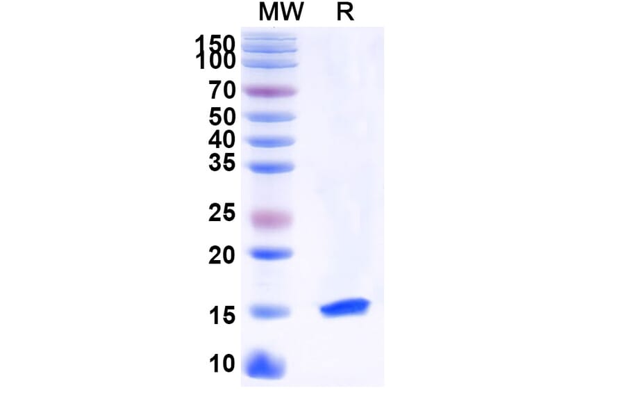 SDS-PAGE - Anti-PTCH1 Nanobody [SAA1040] (A337949) - Antibodies.com