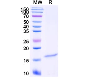 SDS-PAGE - Anti-CRMP1 Nanobody [SAA1228] (A337950) - Antibodies.com