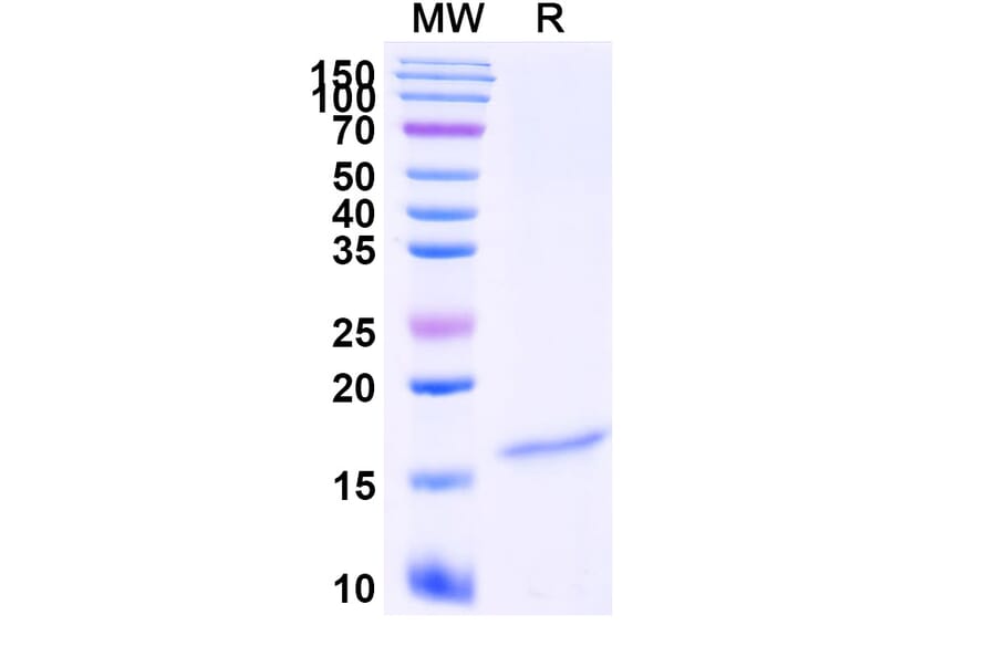 SDS-PAGE - Anti-CRMP1 Nanobody [SAA1228] (A337950) - Antibodies.com