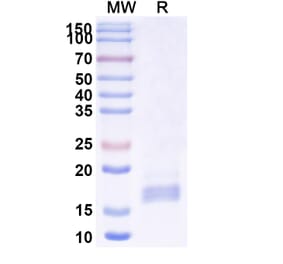 SDS-PAGE - Anti-mGluR2 Nanobody [SAA1127] (A337951) - Antibodies.com