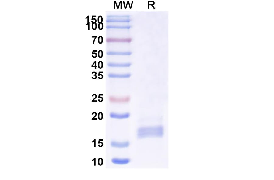 SDS-PAGE - Anti-mGluR2 Nanobody [SAA1127] (A337951) - Antibodies.com