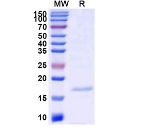 SDS-PAGE - Anti-SLC10A1 Nanobody [SAA1145] (A337953) - Antibodies.com