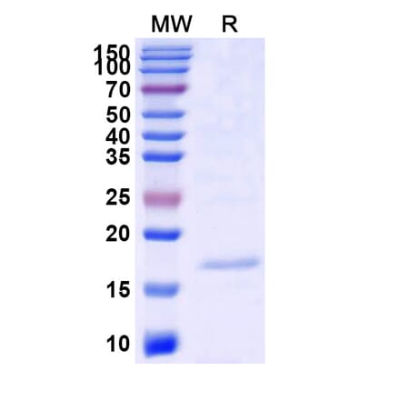 SDS-PAGE - Anti-SLC10A1 Nanobody [SAA1145] (A337953) - Antibodies.com