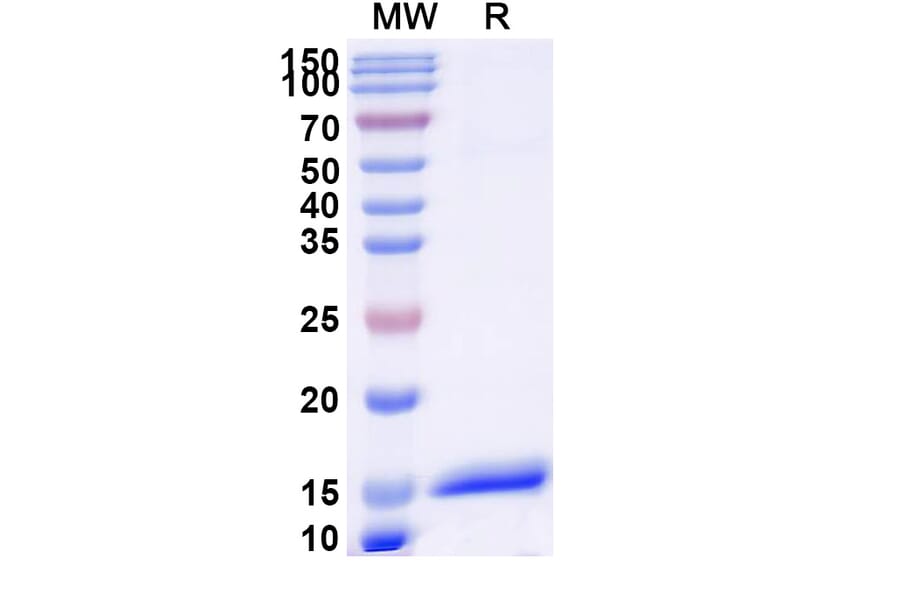 SDS-PAGE - Anti-Angiopoietin 1 Nanobody [SAA1256] (A337957) - Antibodies.com