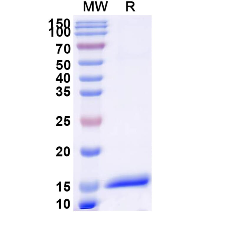 SDS-PAGE - Anti-Angiopoietin 1 Nanobody [SAA1256] (A337957) - Antibodies.com