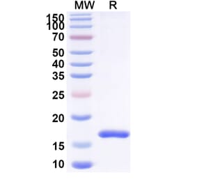 SDS-PAGE - Anti-OGR1 Nanobody [SAA1363] (A337958) - Antibodies.com