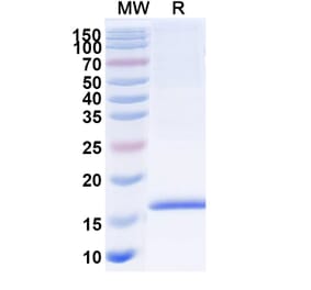 SDS-PAGE - Anti-Adiponectin Nanobody [SAA1153] (A337959) - Antibodies.com