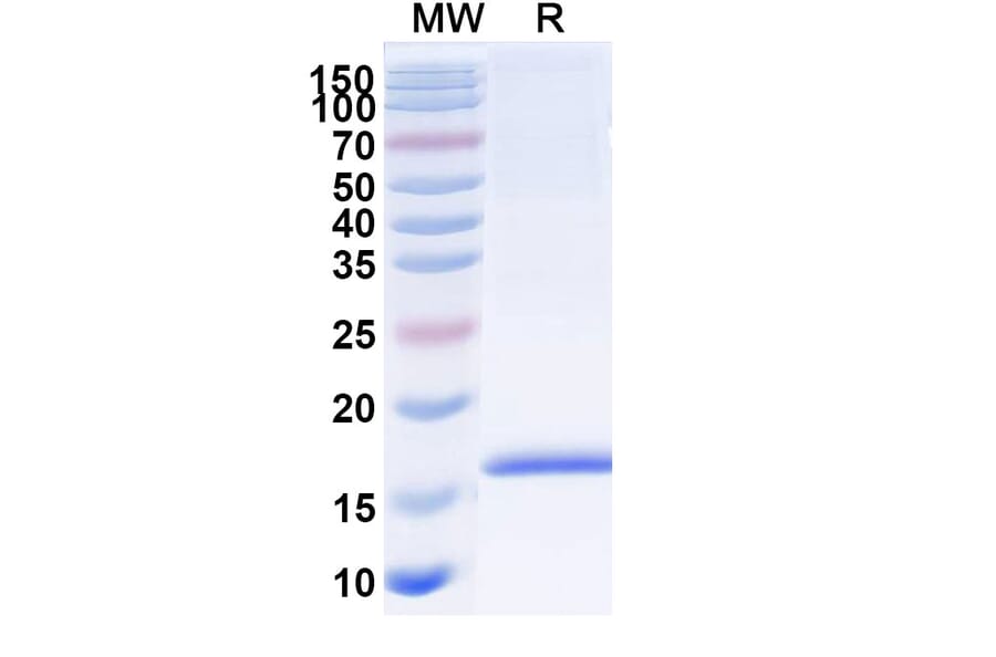 SDS-PAGE - Anti-Adiponectin Nanobody [SAA1153] (A337959) - Antibodies.com