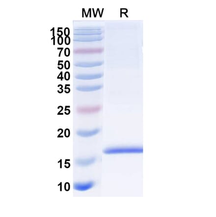 SDS-PAGE - Anti-Adiponectin Nanobody [SAA1153] (A337959) - Antibodies.com