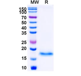 SDS-PAGE - Anti-Melan-A Nanobody [SAA1259] (A337960) - Antibodies.com