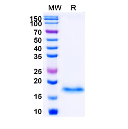 SDS-PAGE - Anti-Melan-A Nanobody [SAA1259] (A337960) - Antibodies.com