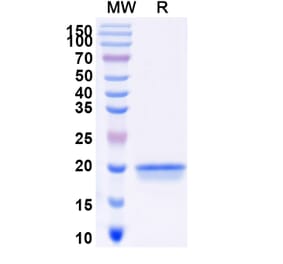 SDS-PAGE - Anti-DDR2 Nanobody [SAA0978] (A337962) - Antibodies.com