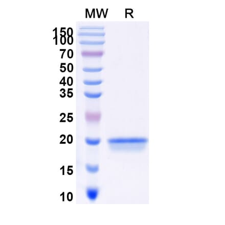 SDS-PAGE - Anti-DDR2 Nanobody [SAA0978] (A337962) - Antibodies.com