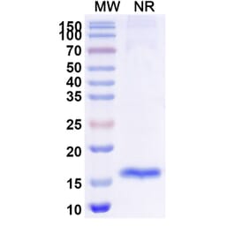 SDS-PAGE - Anti-IL-23R Nanobody [SAA1299] (A337963) - Antibodies.com