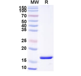SDS-PAGE - Anti-ARC Nanobody [SAA0943] (A337964) - Antibodies.com