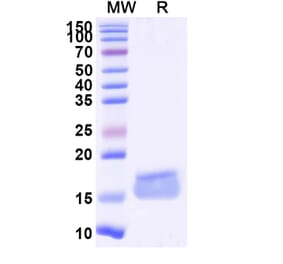 SDS-PAGE - Anti-KLB Nanobody [SAA1090] (A337966) - Antibodies.com