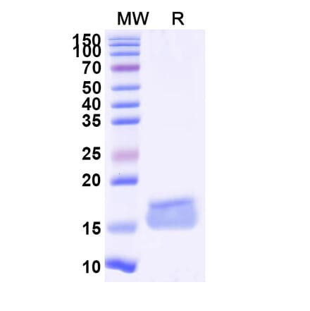 SDS-PAGE - Anti-KLB Nanobody [SAA1090] (A337966) - Antibodies.com