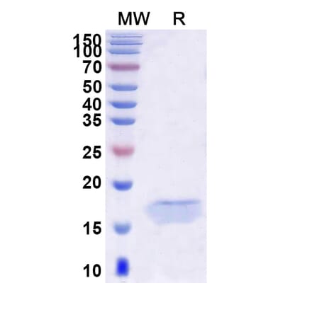 SDS-PAGE - Anti-PCSK9 Nanobody [SAA0995] (A337968) - Antibodies.com