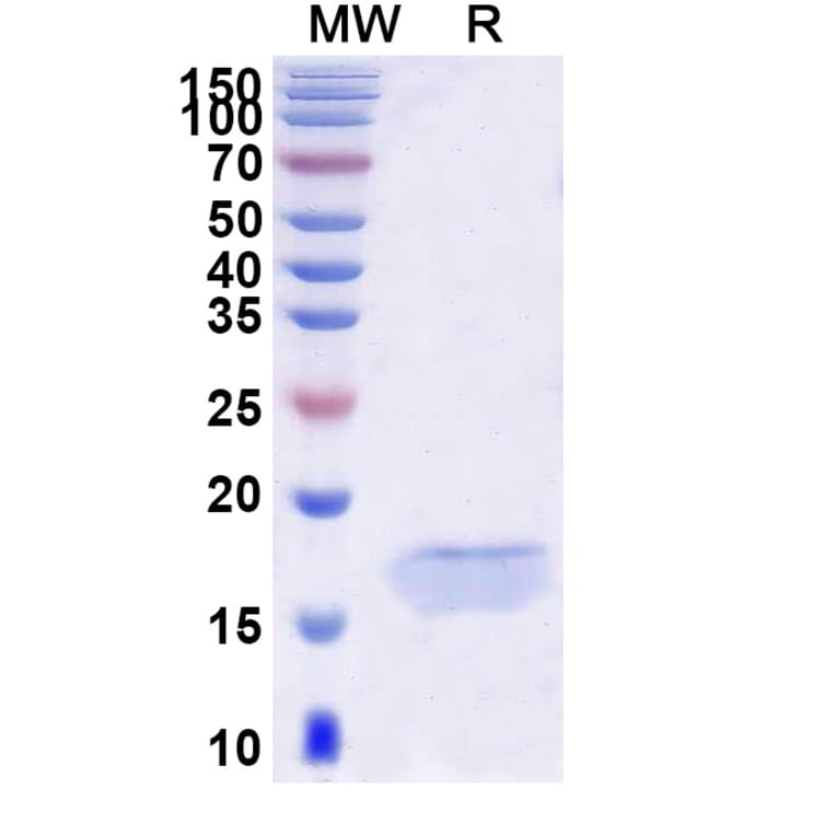 SDS-PAGE - Anti-PCSK9 Nanobody [SAA0995] (A337968) - Antibodies.com