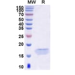 SDS-PAGE - Anti-PCSK9 Nanobody [SAA0995] (A337968) - Antibodies.com