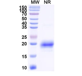 SDS-PAGE - Anti-TIM 3 Nanobody [SAA1348] (A337969) - Antibodies.com