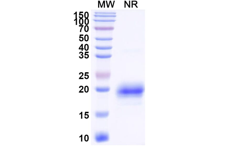 SDS-PAGE - Anti-TIM 3 Nanobody [SAA1348] (A337969) - Antibodies.com