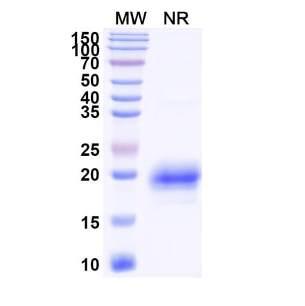 SDS-PAGE - Anti-TIM 3 Nanobody [SAA1348] (A337969) - Antibodies.com
