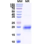 SDS-PAGE - Anti-TIM 3 Nanobody [SAA1348] (A337969) - Antibodies.com