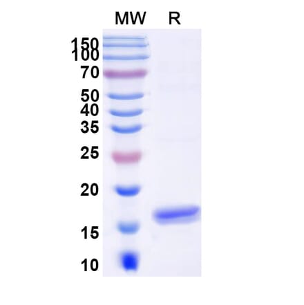 SDS-PAGE - Anti-MUC16 Nanobody [SAA1355] (A337970) - Antibodies.com