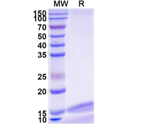 SDS-PAGE - Anti-IL-17RA Nanobody [SAA1266] (A337971) - Antibodies.com