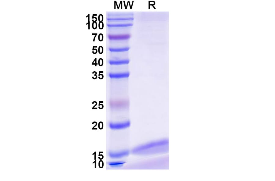 SDS-PAGE - Anti-IL-17RA Nanobody [SAA1266] (A337971) - Antibodies.com