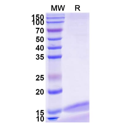 SDS-PAGE - Anti-IL-17RA Nanobody [SAA1266] (A337971) - Antibodies.com