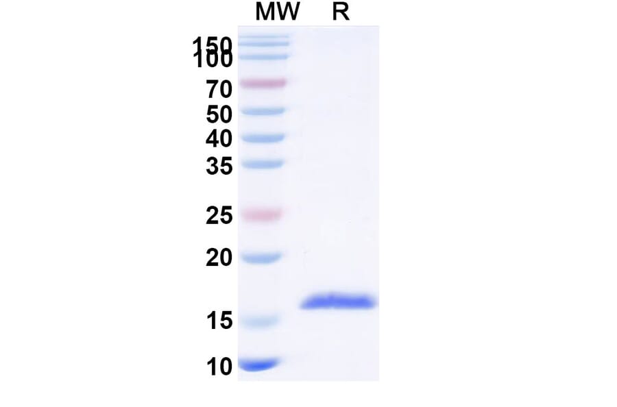 SDS-PAGE - Anti-Carboxypeptidase B2 Nanobody [SAA1167] (A337972) - Antibodies.com