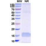 SDS-PAGE - Anti-Carboxypeptidase B2 Nanobody [SAA1017] (A337973) - Antibodies.com