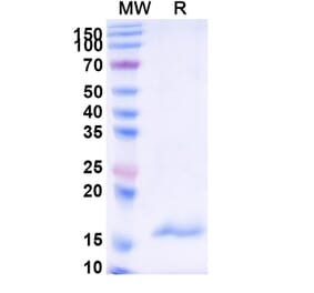SDS-PAGE - Anti-Carboxypeptidase B2 Nanobody [SAA1018] (A337974) - Antibodies.com