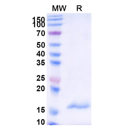 SDS-PAGE - Anti-Carboxypeptidase B2 Nanobody [SAA1018] (A337974) - Antibodies.com