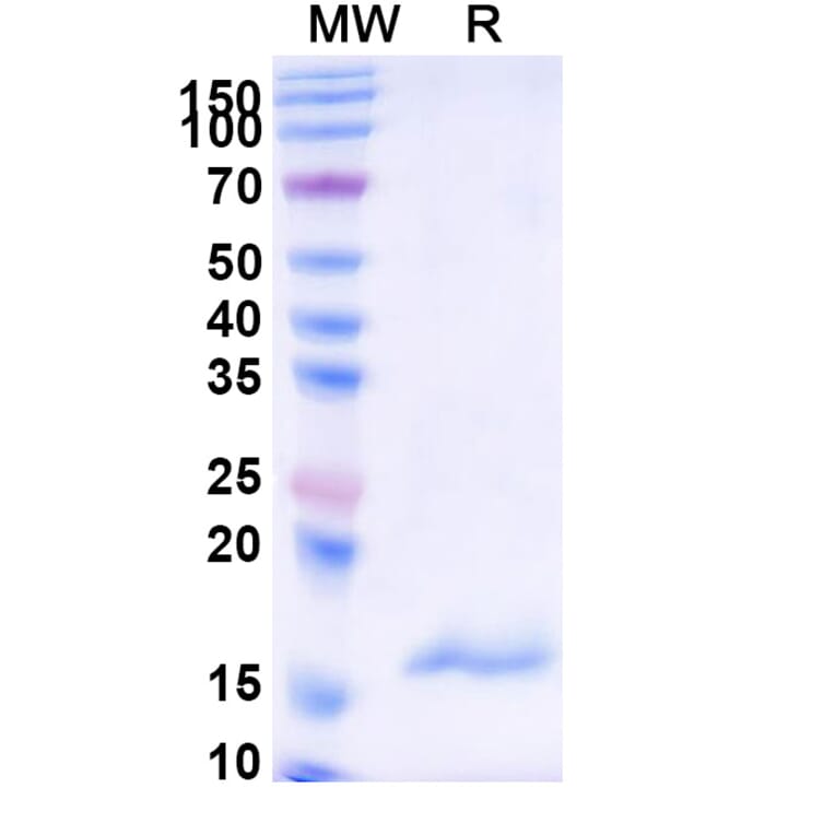 SDS-PAGE - Anti-Carboxypeptidase B2 Nanobody [SAA1018] (A337974) - Antibodies.com