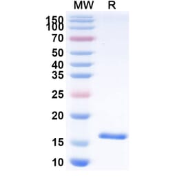 SDS-PAGE - Anti-Carboxypeptidase B2 Nanobody [SAA1041] (A337975) - Antibodies.com