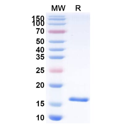 SDS-PAGE - Anti-Carboxypeptidase B2 Nanobody [SAA1041] (A337975) - Antibodies.com