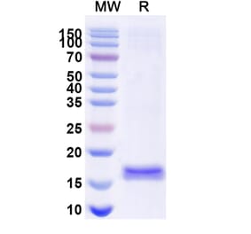 SDS-PAGE - Anti-G-CSFR Nanobody [SAA1247] (A337976) - Antibodies.com