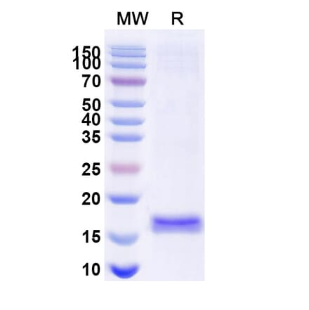 SDS-PAGE - Anti-G-CSFR Nanobody [SAA1247] (A337976) - Antibodies.com