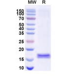 SDS-PAGE - Anti-G-CSFR Nanobody [SAA1247] (A337976) - Antibodies.com